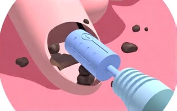 挠脚心最爱解压游戏